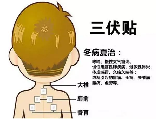 2、三伏貼的功能和功效是什么？